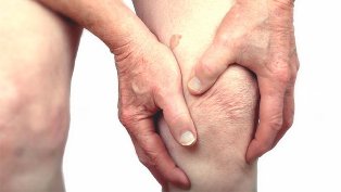 Arthritis und Arthrose des Kniegelenks