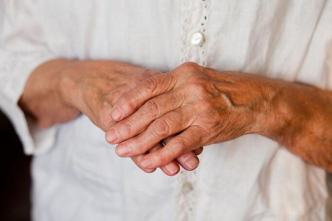 Schmerzen in den Gelenken der Hände stören oft ältere Menschen